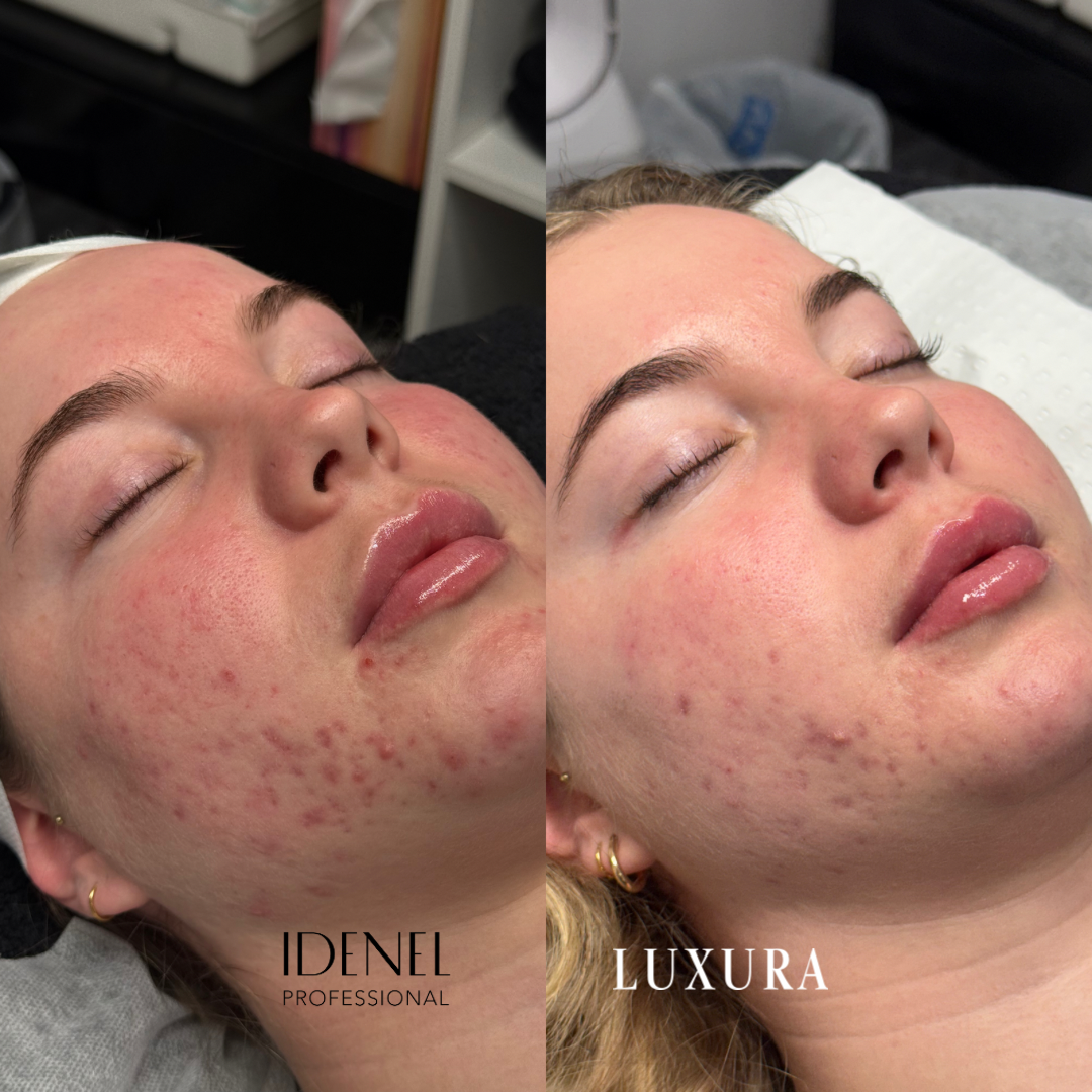 The Korean Skincare Breakthrough you haven’t heard of.. Until Now